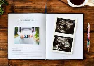 Dear Baby: A Pregnancy Prayer Journal & Memory Book